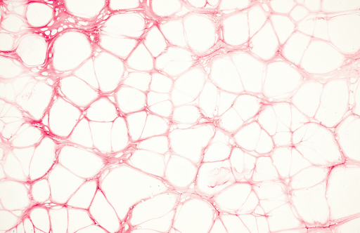 A microscopic view of broken capillaries