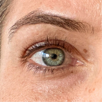 Close-up of a woman after using the NIRA Precision Laser to get rid of hooded eyes