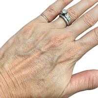 After shot of a woman's hand and the improved skin texture achieved from NIRA's at-home laser