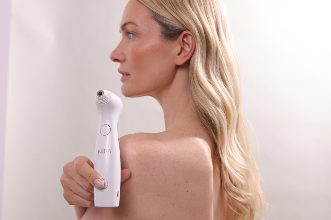 Model holding the NIRA Precision Laser over her shoulder, showcasing the sleek at-home device for collagen renewal and wrinkle reduction.