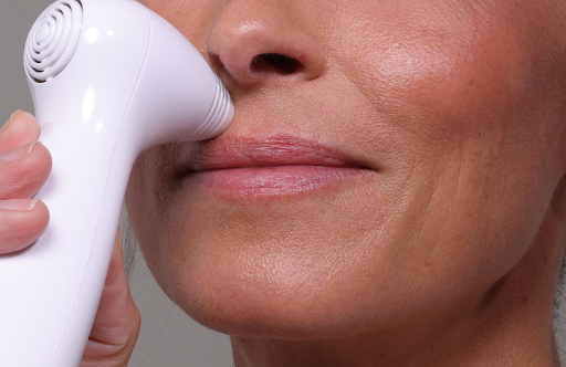 How to Get Rid of Vertical Lip Lines Naturally