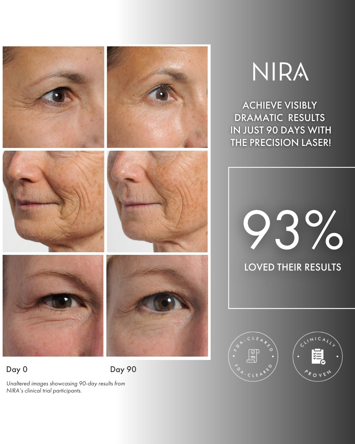 NIRA Precision Laser & Skincare Bundle | Targeted Anti-Aging Trio