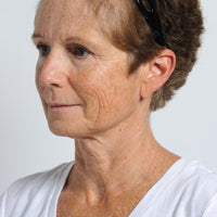 Woman with reduced wrinkles and tightened skin after using NIRA's anti-aging laser