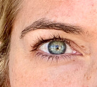 Woman before using NIRA's wrinkle-reducing laser to lift hooded eyes