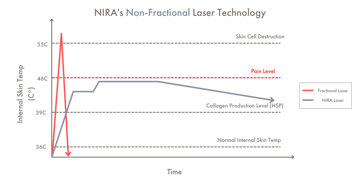 Line graph explaining the science behind NIRA’s non-fractional laser technology