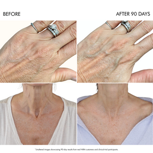 NIRA Pro Laser At-Home Laser Device for Full Wrinkle Reduction