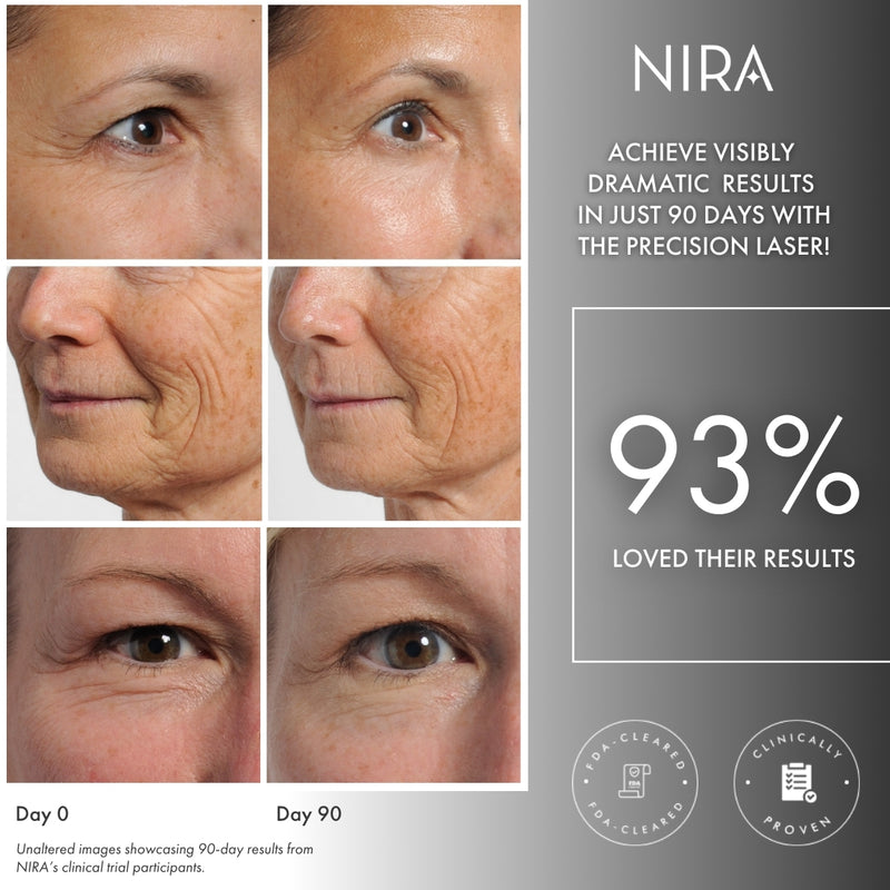 Results of using the NIRA Precision Laser around the eyes and mouth included in the Ultimate Anti-Aging Collection