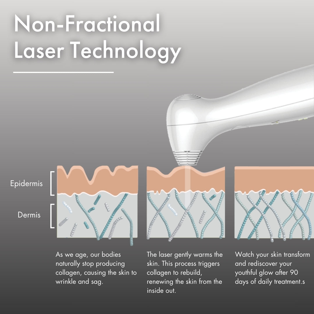 Illustration showing NIRA Pro Laser (10% OFF) using non-fractional laser technology to stimulate collagen and reduce wrinkles.
