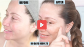 The image shows a split-screen comparison labeled ’before’ and ’after,’ with text indicating “90 days results,” suggesting it’s promoting skincare or cosmetic results.
