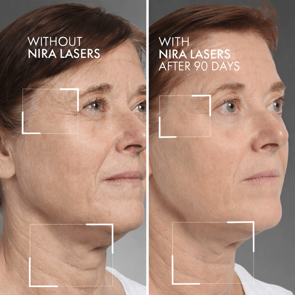 NIRA Pro 3 Laser