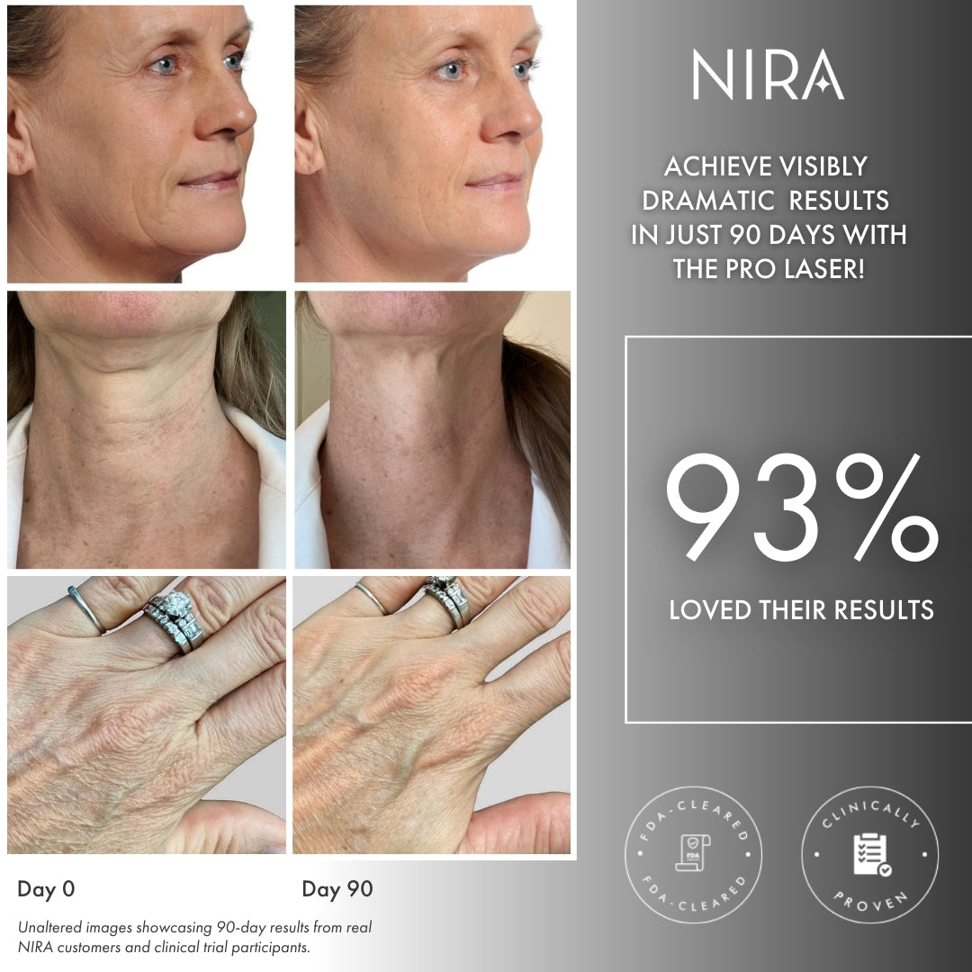 NIRA Pro Laser (10% OFF) before and after photos showing skin improvement on face, neck, and hands after 90 days.