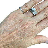 Woman's Hand Before Skin Texture Treatment